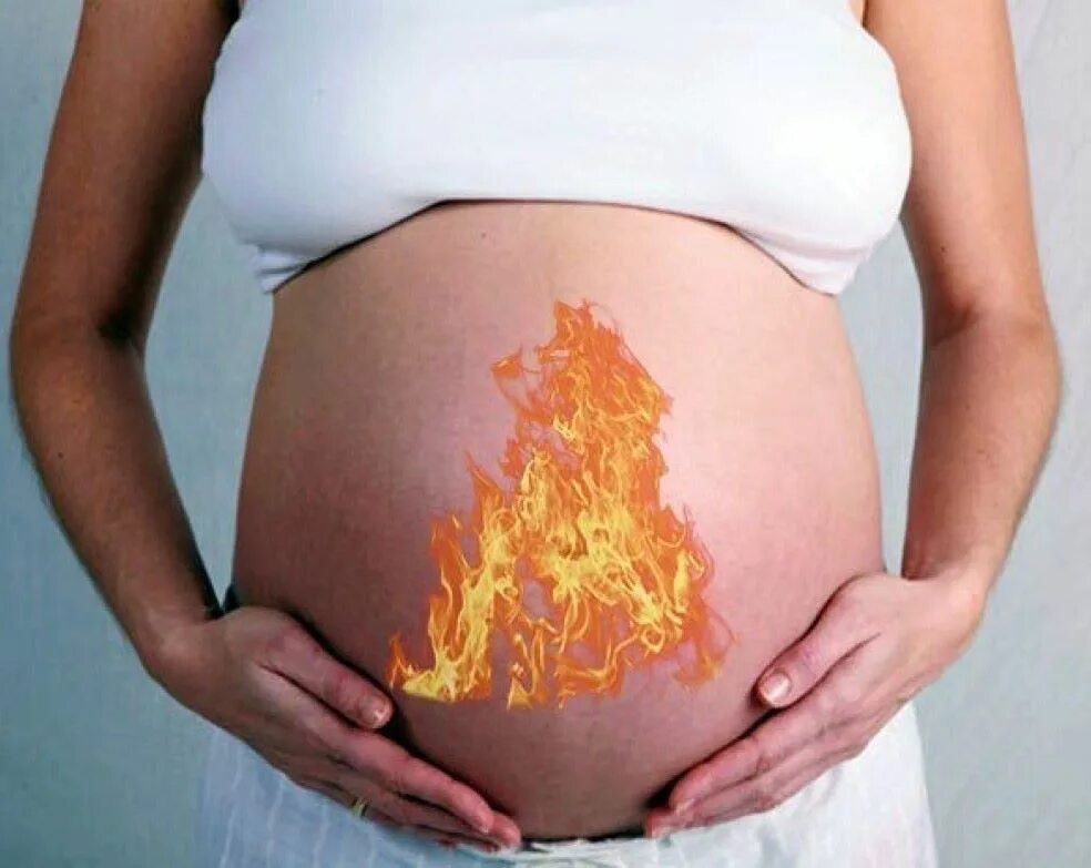 Изжога во 2 триместре. Изжога у беременных. Изжоге прибеременночти. Изжога беременность 3 триместр.