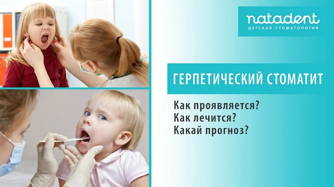 Стоматит у ребенка 3 года как лечить. Стоматит у ребенка 3 года как лечить