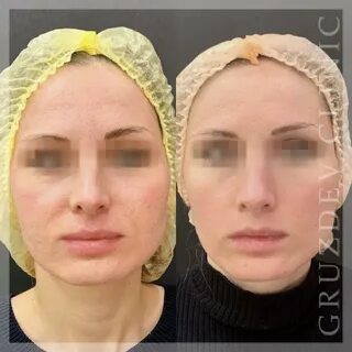 После дот
