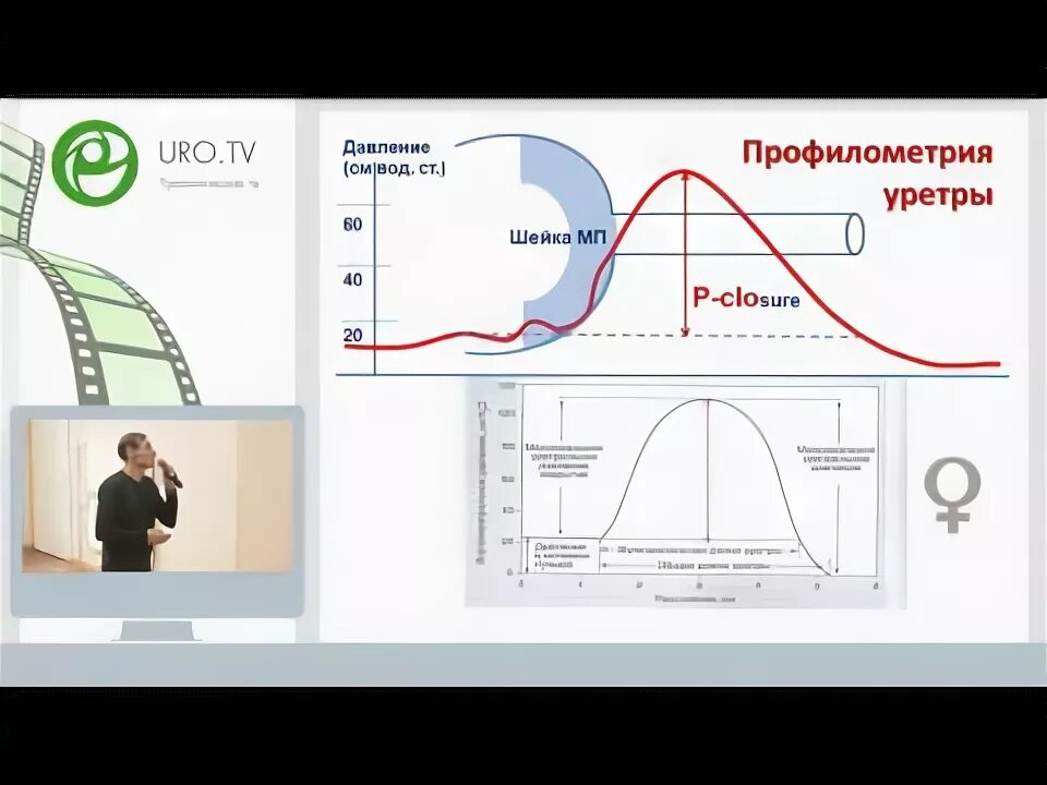 Профилометрия прямой кишки. Антропометрические ориентиры на лице. Толщина пленки на шероховатой поверхности. Профилометрия в проктологии. Профилометрия уретры.