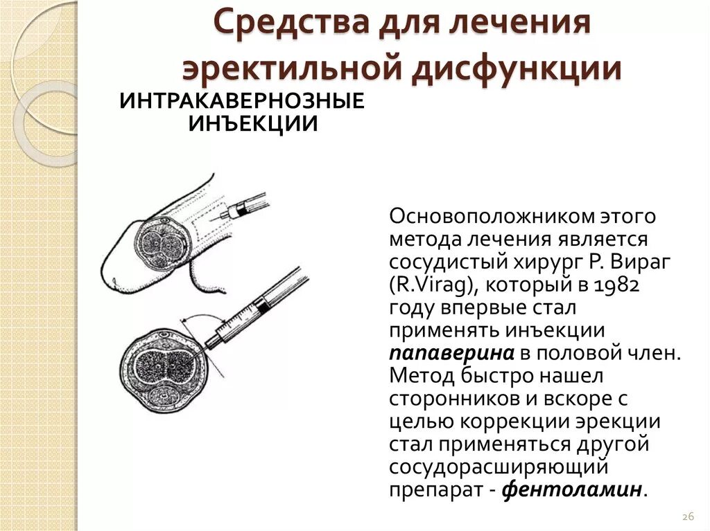 Растягивание члена. Интракавернозное Введение препаратов. Интракавернозных инъекций. Внутрикавернозная инъекция.