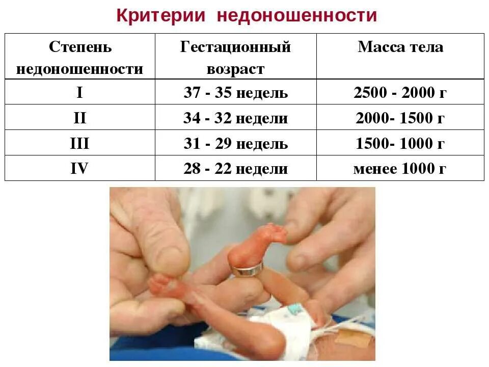 Критерии доношенности и недоношенности новорожденного. Таблица недоношенности новорожденного. Недоношенный ребёнок критерии. Гестационный Возраст недоношенного ребенка. Гестационный возраст ребенка