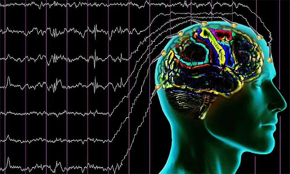 Биоэлектрическая активность коры. Электроэнцефалография (ЭЭГ). ЭЭГ (электроэнцефалограмма) головного мозга. Электроэнцефалография (ЭЭГ) метод исследования. Визуализация мозга.
