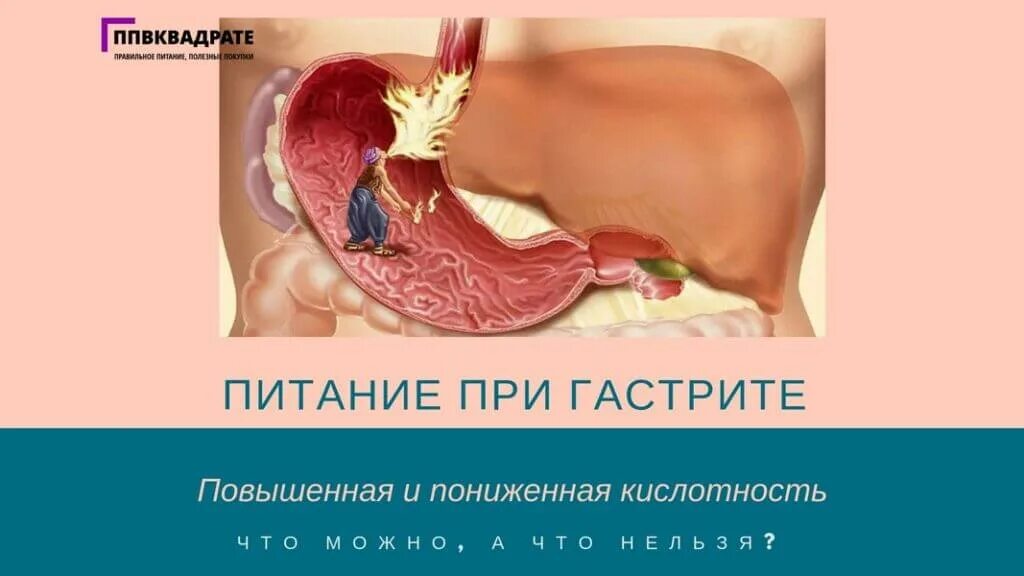 Еда при гастрите. При гастрите. гастрит повышенная кислотность. повышенная кислотность при гастрите.