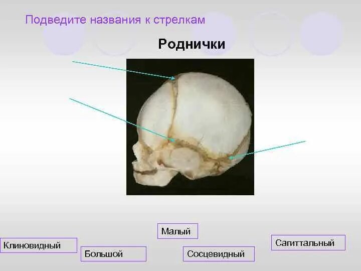 Передний родничок черепа новорожденного. Клиновидный родничок. Череп новорожденного и указать роднички. Клиновидный родничок строение. Череп младенца темечко.