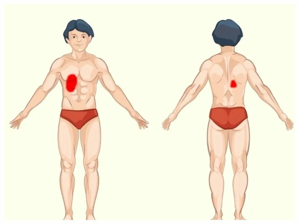 Локализация боли в теле. Части тела. Почеи локализация боли. Место локализации боли. Как отличить боль в легких