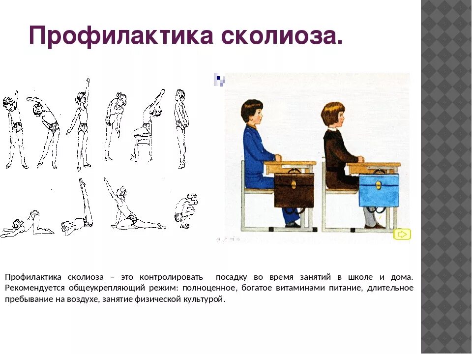 Нарушение осанки у детей. Первичная профилактика сколиоза у детей. профилактика сквлеоза у детей. профилактика искривления позвоночника. профилактика сколиоза памятка.