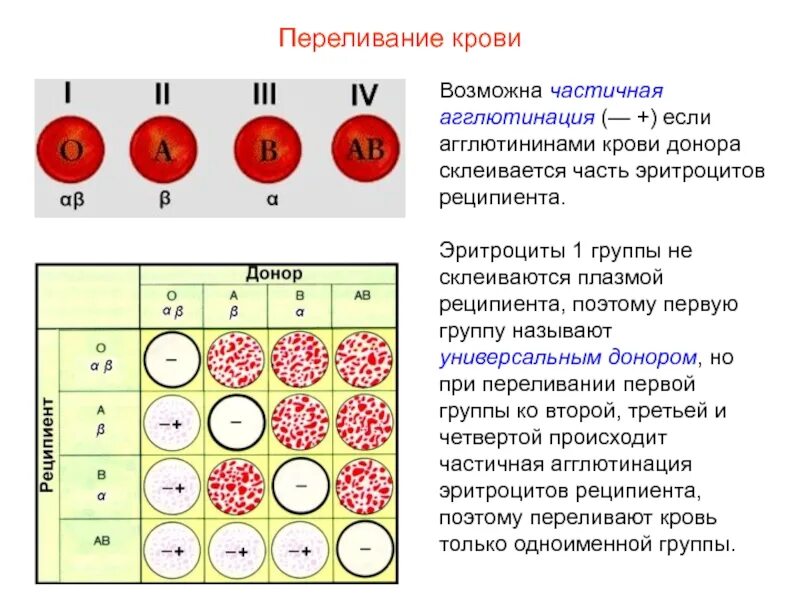 Какая группа является универсальным реципиентом. Агглютинация с 1 и 3 группой крови. Агглютинация эритроцитов. Агглютинация эритроцитов группа крови. Эритроциты в первой группе гр крови.