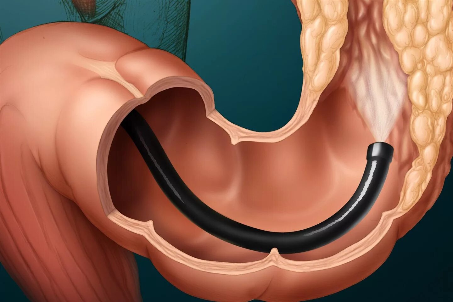 Видеоколоноскопия (фкс). Колоноскопия жкт. Эндоскоп прибор в медицине. Колоноскопия кишечника для профилактики. Ректоскопия, ректороманоскопия, колоноскопия.