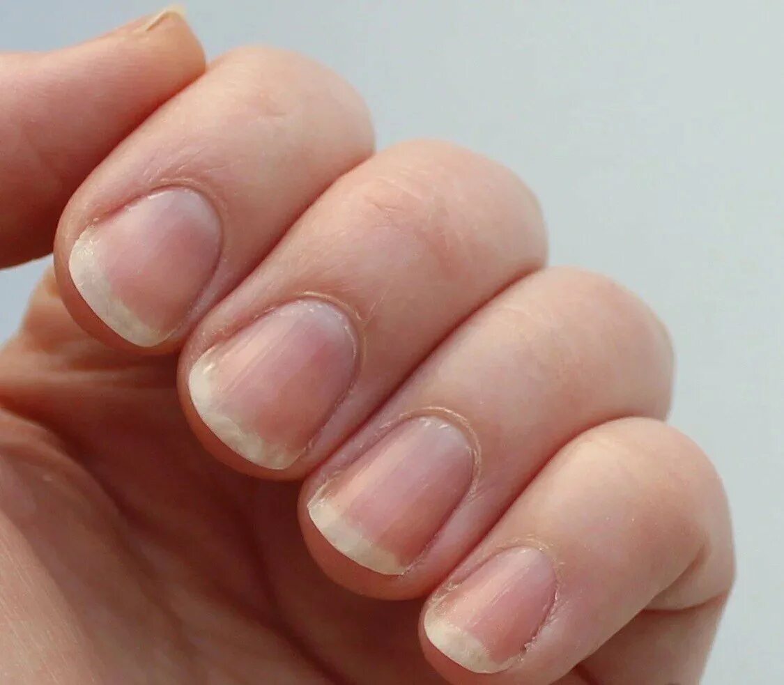 Форма ногтей трапеция. Широкие ногти. Трапециевидные ногти. Широкая ногтевая пластина. Трапециевидная форма ногтей.