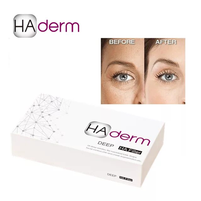 Производство филлеров. Haderm филлер. Juveline Derm филлер. Филлер ha Derm (Derm). Bio Gel филлер.