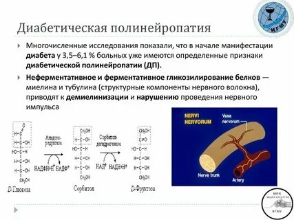 Диабет полинейропатия нижних конечностей лечение препараты