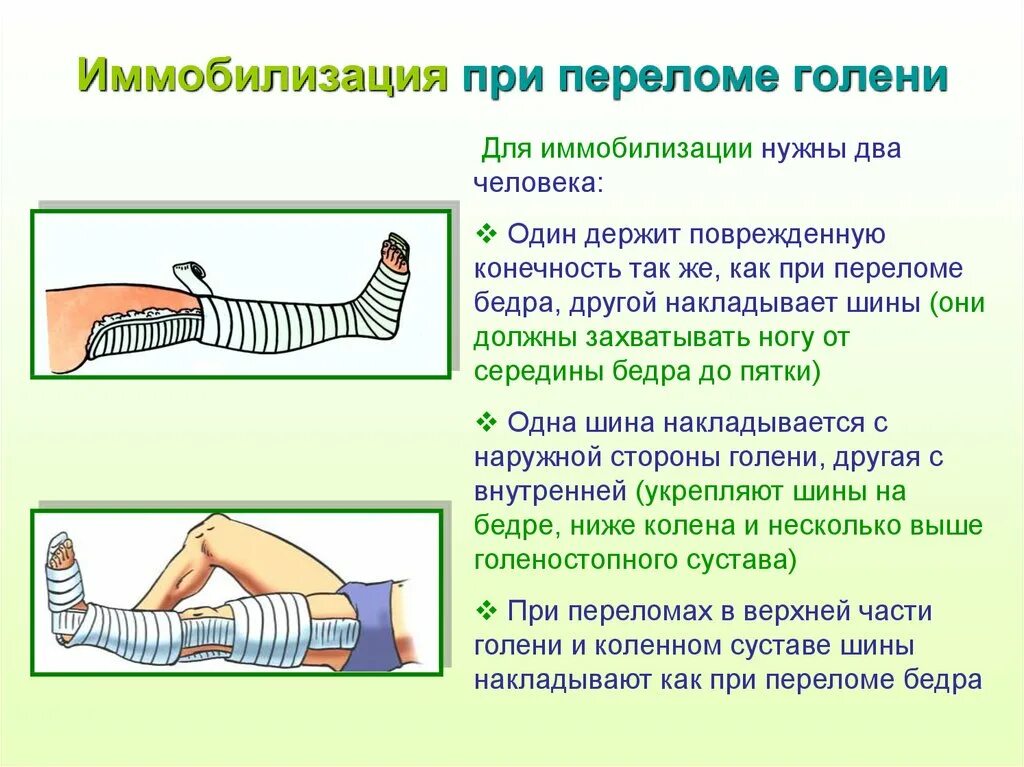 Последовательность при открытом переломе тест. Транспортная иммобилизация при переломе голени. При переломе костей голени иммобилизируют. Транспортная иммобилизация перелома бедра алгоритм. Транспортная иммобилизация костный перелом голени.