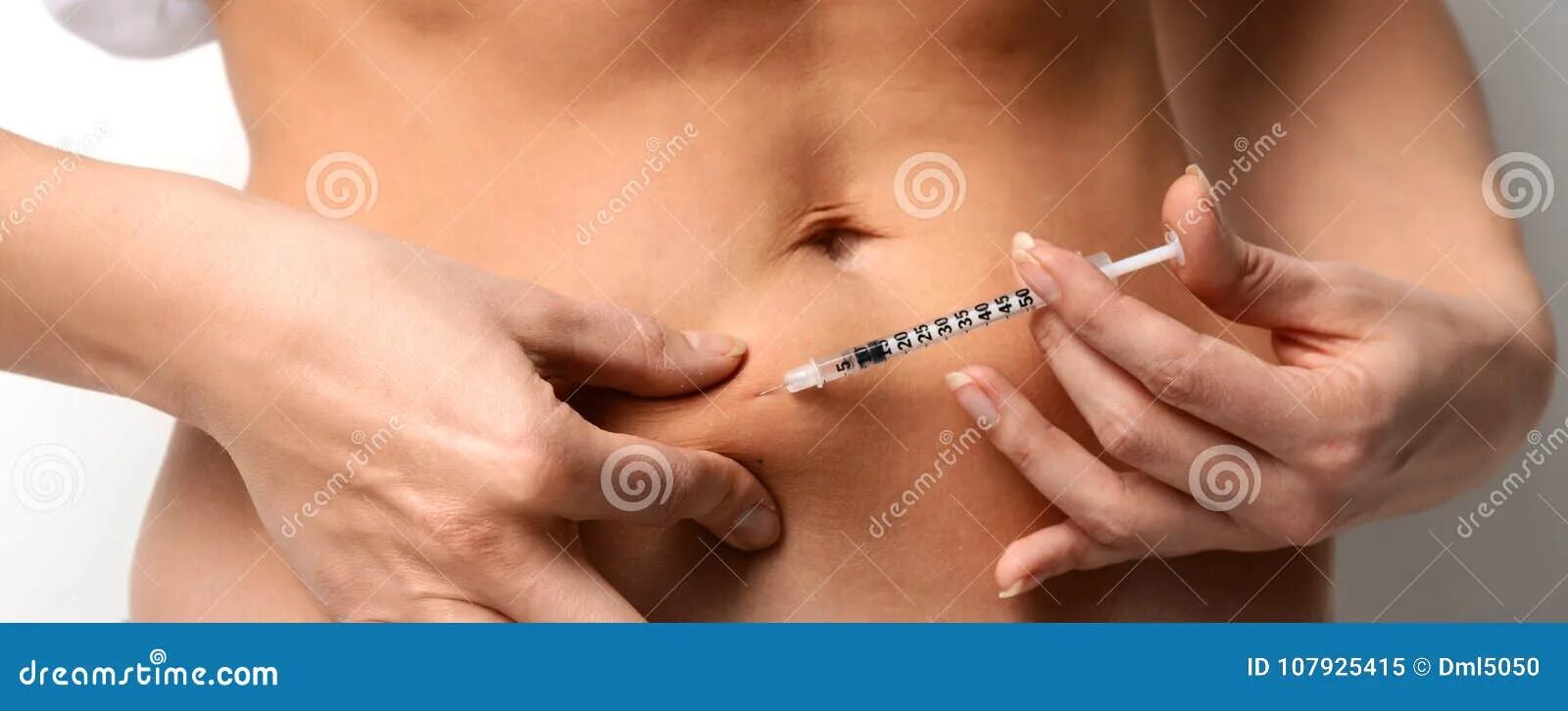 Using a Gonal-f pre-filled pen IUI #1 with injectables - YouTube