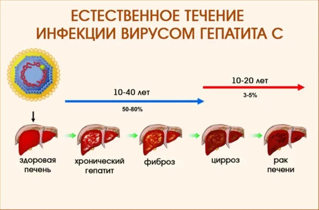 Сколько живут с гепатитом б