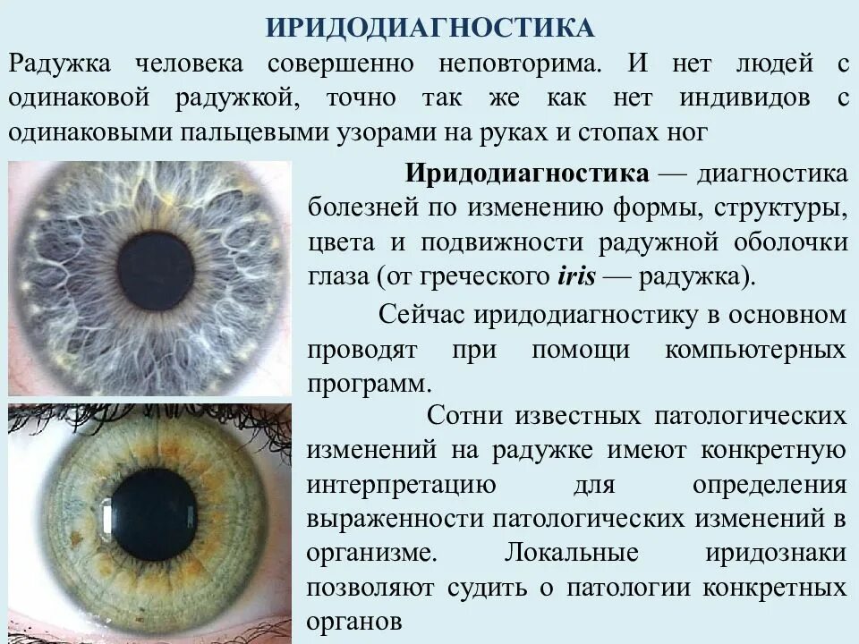 Радужная оболочка глаза человека и заболевания