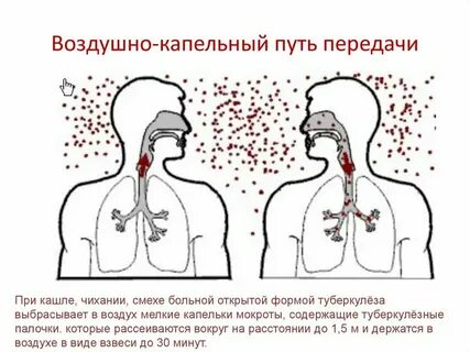 Воздушно капельные инфекции диагностика
