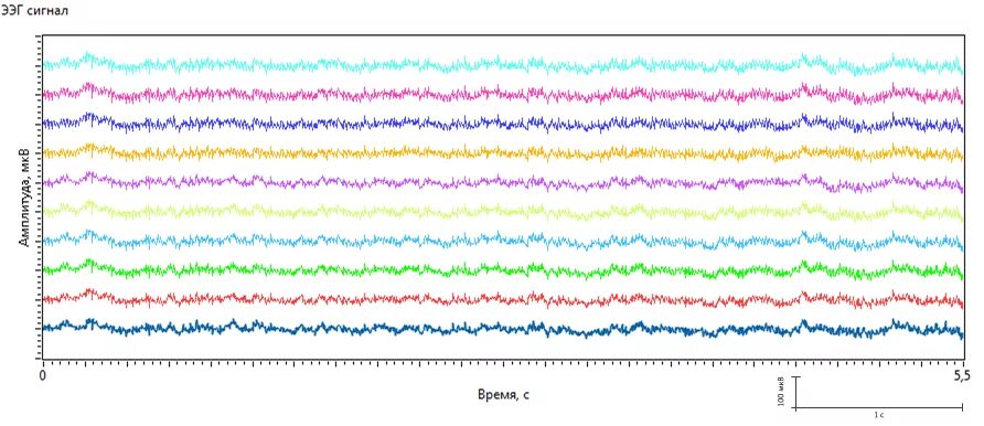 Ээг 2 часа. Схема ЭЭГ 10-20. 10-20 EEG. Электроэнцефалография схема 10 20. Схема 10 20 при ЭЭГ.