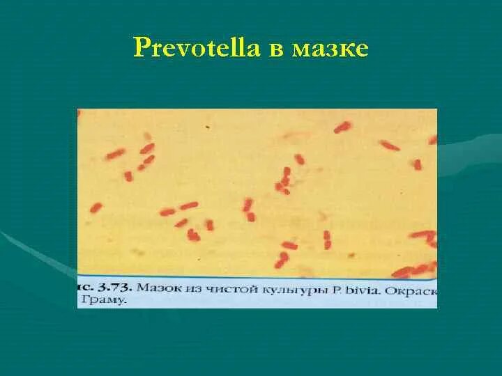 Prevotella spp в мазке у женщин