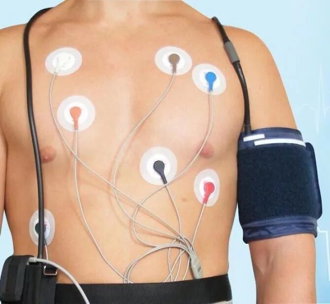 Аппарат холтеровского мониторирования сердечного ритма. Суточное мониторирование спб. Суточное мониторирование спб. Суточное холтеровское мониторирование ад и экг. Суточное мониторирование спб.