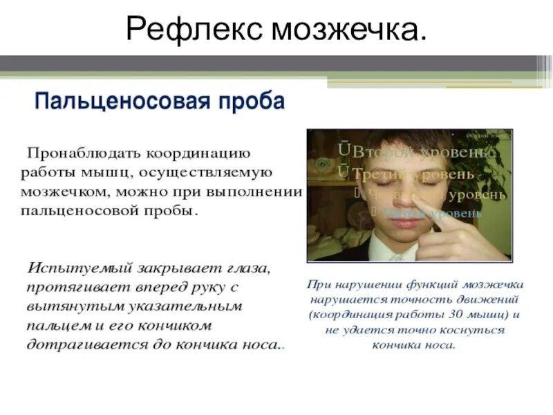 Практическая работа рефлексы. Рефлексы мозжечка. Рефлексы мозжечка в головном мозге. Рефлексы мозжечка примеры. Рефлексы мозжечка у человека.