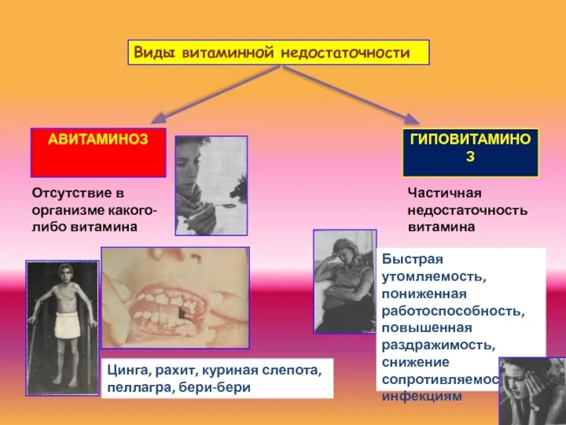 Оптимальные пути профилактики витаминной недостаточности ответ. Профилактика витаминной недостаточности. Болезни витаминной недостаточности. Авитаминоз разновидности. Виды витаминной недостаточности.