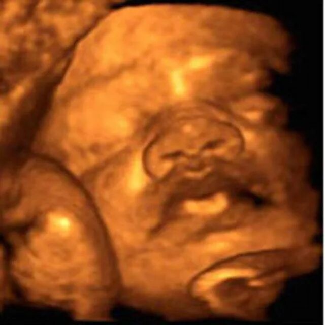 31 неделя беременности фото плода на узи. 32 неделя фото плода. 31 неделя беременности фото плода на узи. 32 неделя фото плода. 32 неделя фото плода.