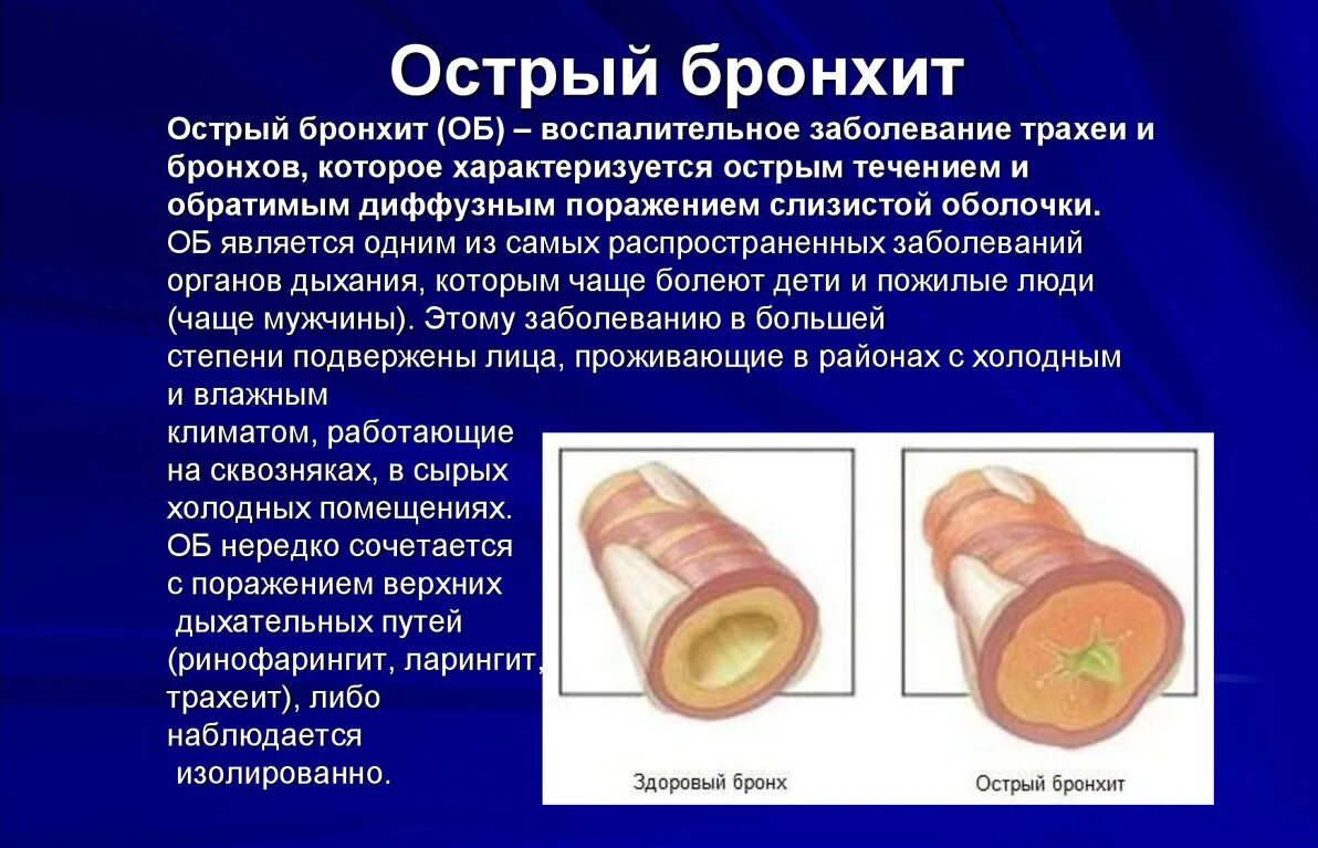 Причины частых бронхитов. Бронхит и острый бронхит. При остром бронхите поражаются бронхи.