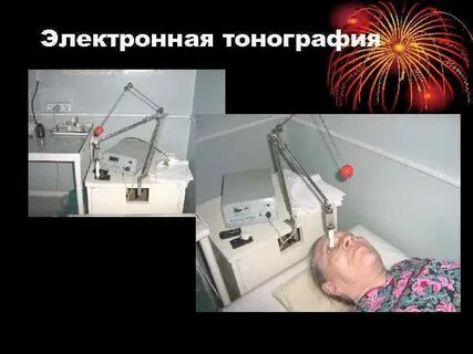 Тонография