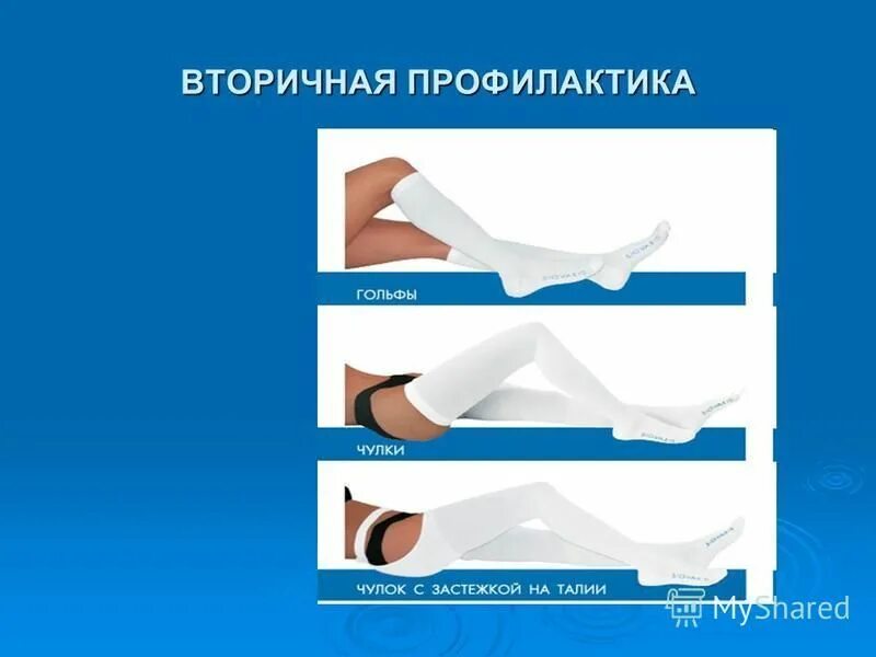 Тромбоэмболия после операции. Методы профилактики Тэла. Профилактика тромбоэмболии. Профилактика при Тэла. Первичная и вторичная профилактика Тэла.