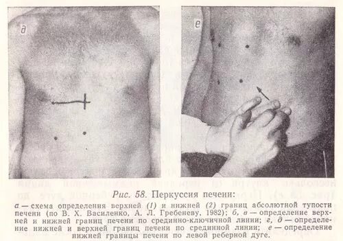 Печень у края реберной. Пальпация и перкуссия печени по курлову. Перкуссия Нижнего края печени. Перкуссия печени нижняя граница. Перкуссия селезенки по курлову.