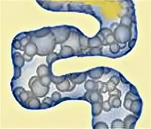 аэроколия что это. жалобы при гепатомегалии. максиган уколы. обследование у гастроэнтеролога. умеренные признаки аэроколии.