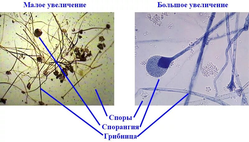 Строение плесневого гриба мукор. Гриб мукор строение под микроскопом. Плесневые грибы Mucor. Микропрепарат плесневого гриба мукора под микроскопом.