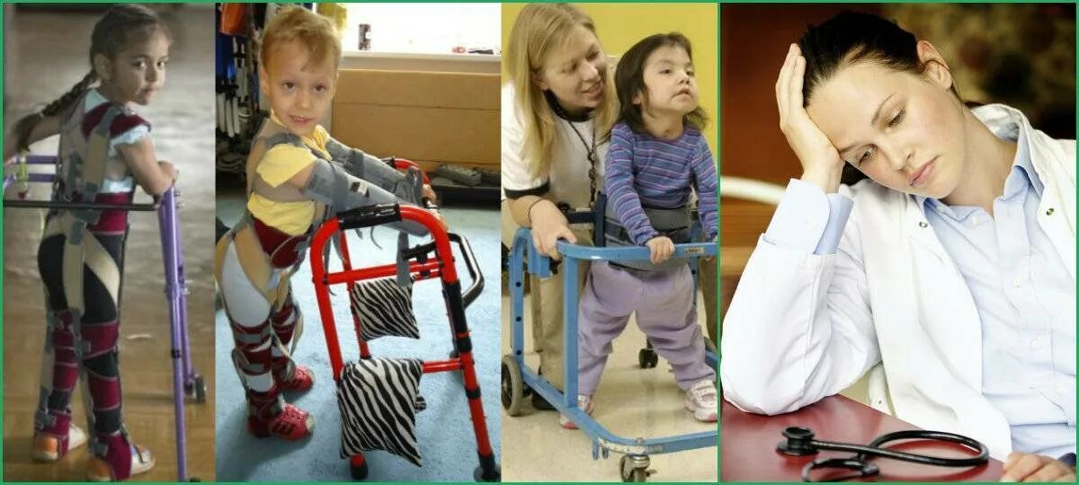 Дцп врожденное заболевание. Парезы и параличи при дцп. церебральный паралич дцп. диагноз дцп у ребенка. g80.8 дцп.