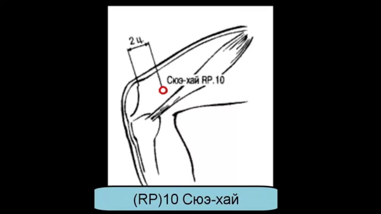 Где находится хай. Точка Сюэ-Хай (SP-10). Точка Сюэ Хай sp10 расположение. Сюе Хай точка акупунктуры. Rp10 точка акупунктуры.