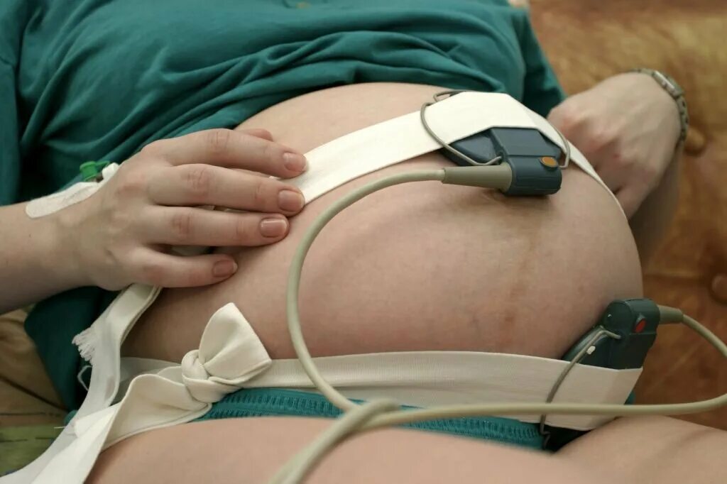 Исследование сердцебиения плода. КТГ. КТГ беременности. Аппарат КТГ. Кардиотокография при беременности.