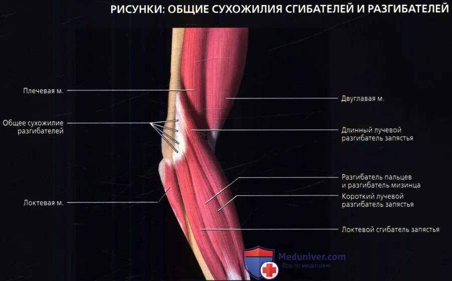 Локтевой сустав мышцы и сухожилия. Сухожилия разгибателей локтевого сустава. Анатомия локтевого сустава мышцы связки сухожилия. Мышцы локтевого сустава анатомия таблица. Общее сухожилие разгибателей локтевого сустава.