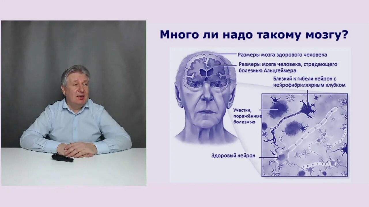 Болезнь альцгеймера препараты. Болезнь Альцгеймера. Терапия болезни Альцгеймера. Тремор при болезни Альцгеймера. Августа Альцгеймера болезнь.