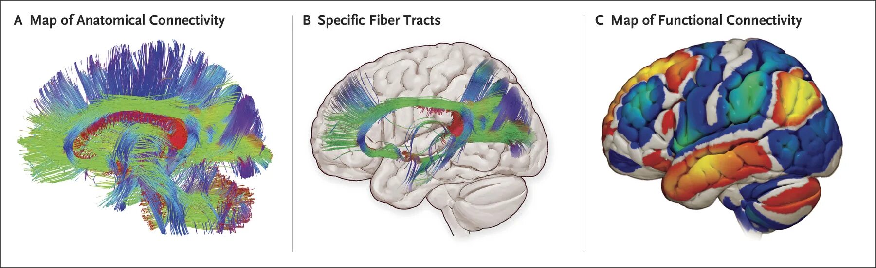 Brain карта. Brain Map function. Цветной мозг анатомия. Connectome коннектома. The Brain Maps человек.
