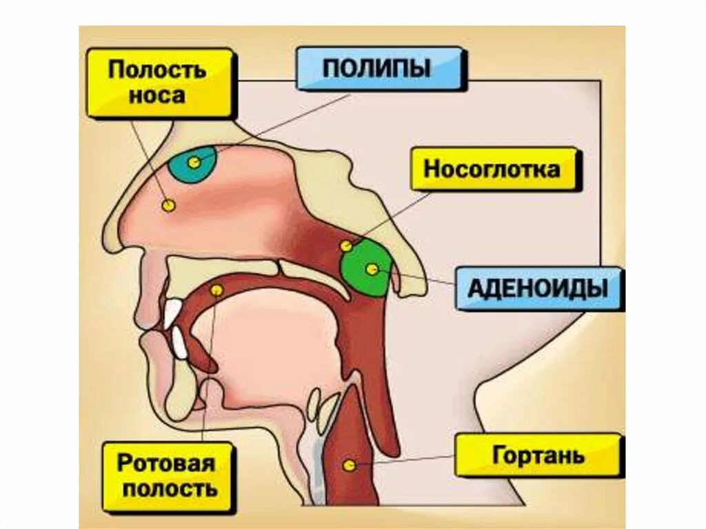 Как вылечить носоглотку