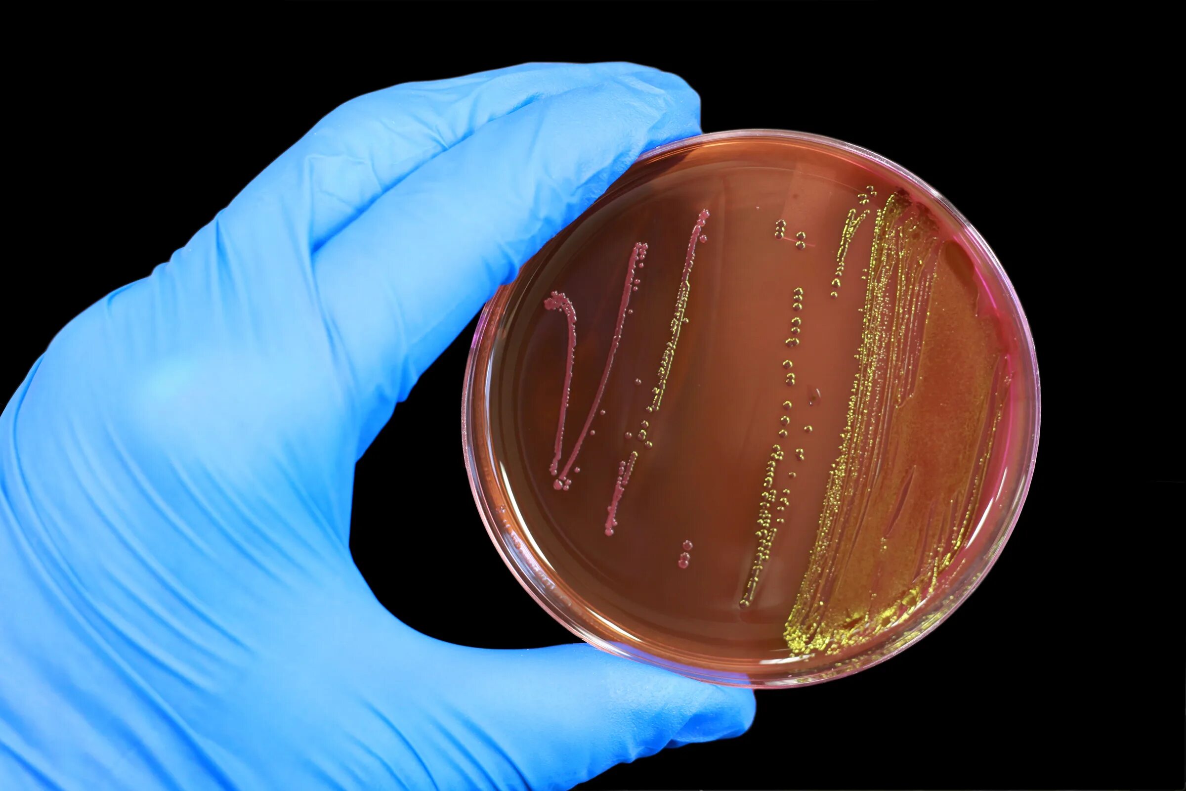 Кишечная палочка Escherichia coli. Эшерихия кишечная палочка. Кишечная палочка Еscherichia coli. Escherichia coli эшерихии. Кишечная палочка в моче причины лечение