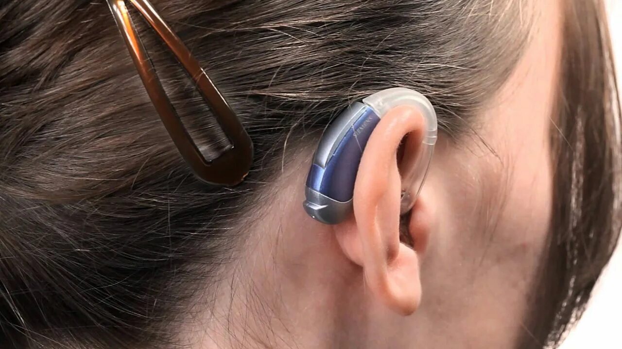 Где подобрать слуховой аппарат. Заушные слуховые аппараты (BTE). Слуховой аппарат Нео классика 675p. Слуховой аппарат цифровой заушный мощный. Audifon слуховые аппараты.