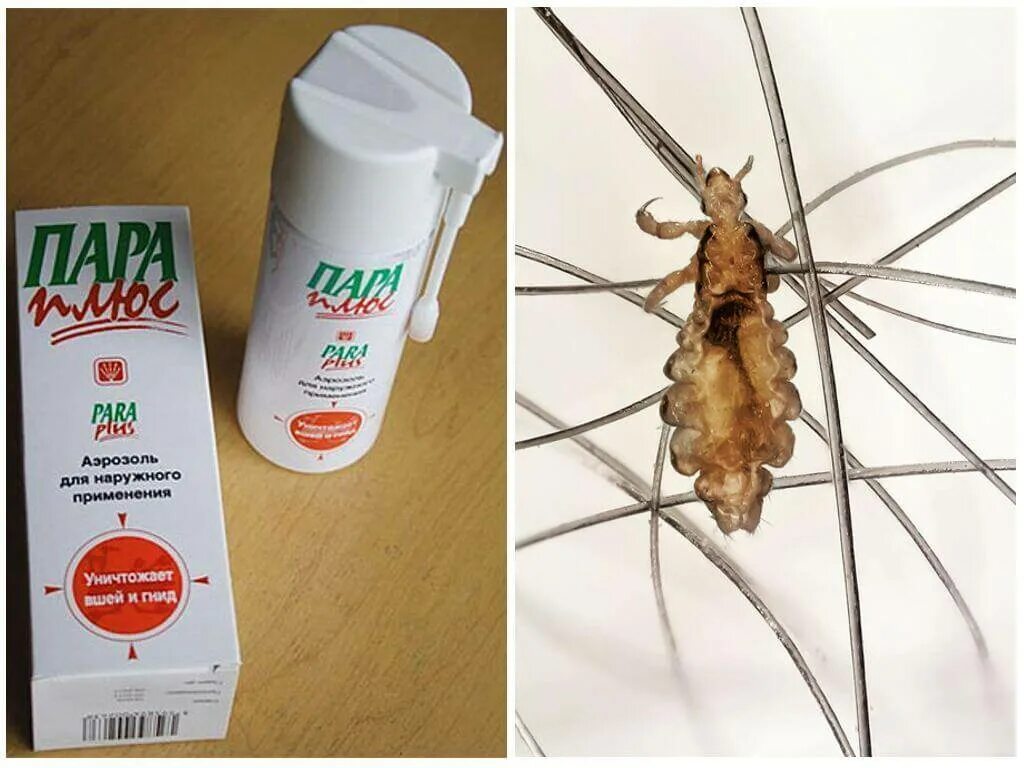 Керосин от вшей и гнид. Керосин от вшей и гнид. Народные средства от вшей. Керосин для волос от вшей. Избавление от вшей и гнид уксусом.