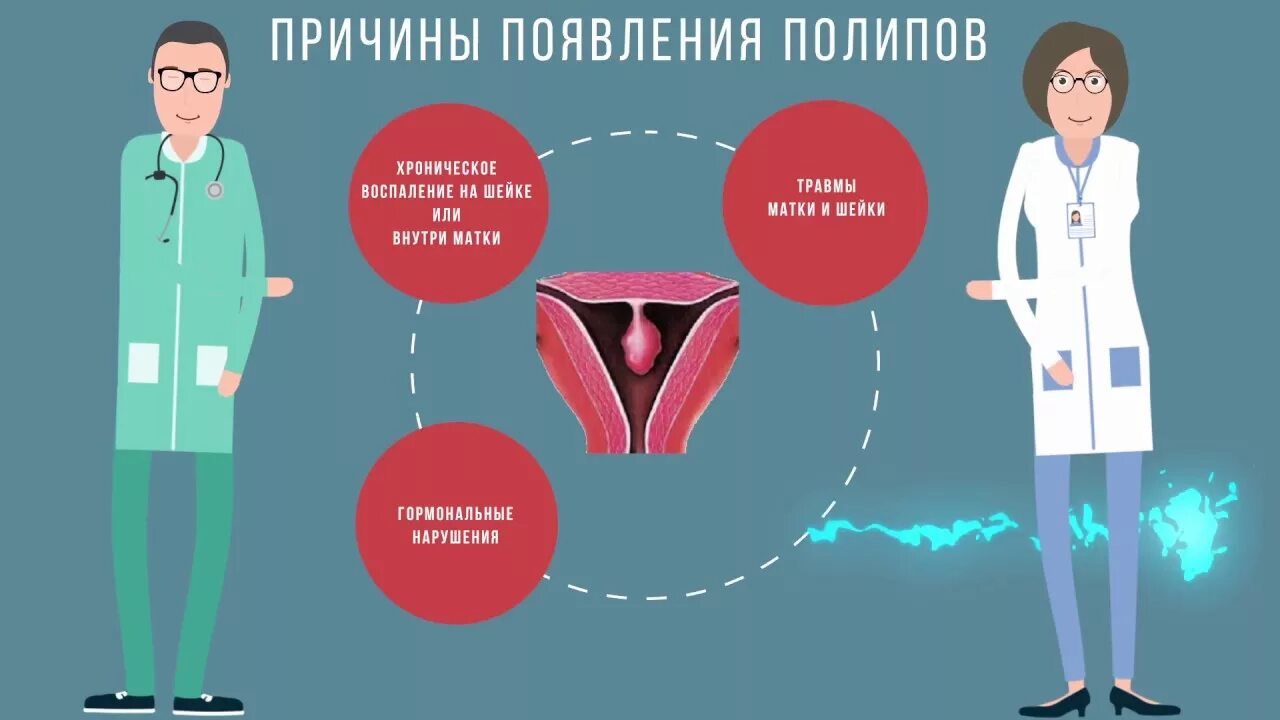 Полип цервикального канала. Удаление полипа цервикального канала. Причины появления полипа в матке. Причины появления полипов.