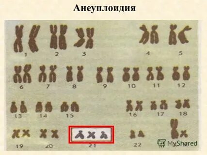 Анеуплоидия