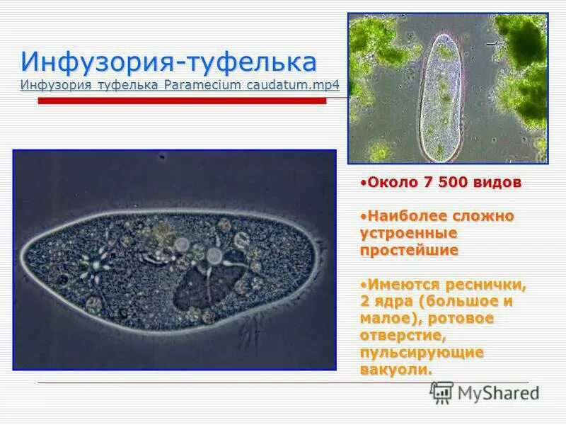 Инфузория движутся. Инфузория царство. Инфузория туфелька реснички. Большое и Малое ядро у инфузории. Ядра инфузории туфельки.