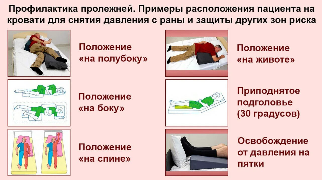 Пролежни у тяжелобольных пациентов профилактика пролежней. Профилактика пролежнч. Пролежни памятка для пациента. Профилактика пролежней памятка. Изменение положения женщины