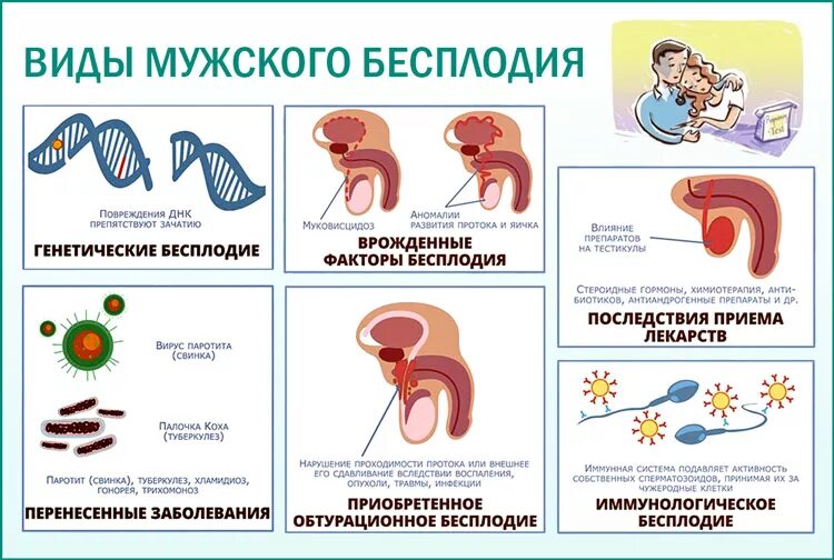 Секреторная форма мужского бесплодия. Классификация мужского бесплодия. Причины мужского бесплодия. Причины бесплодия классификация. Бесплодие у мальчиков