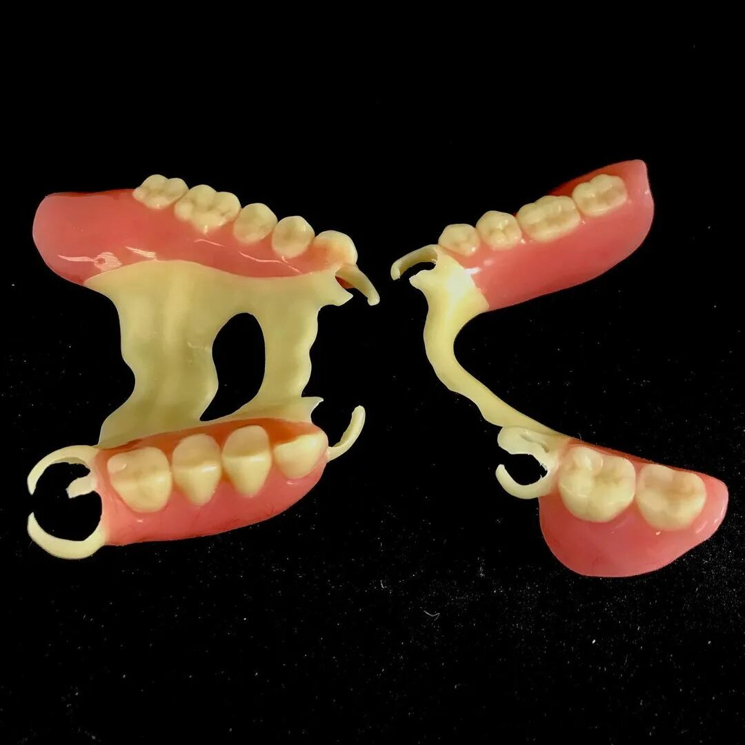 зубные протезы квадротти отзывы