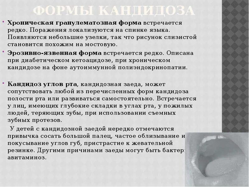 Кандидоз слизистой лечение. Схема лечения кандидоза полости рта у взрослых. Кандидоз слизистой лечение. Кандидоз слизистой лечение. Кандидоз слизистой лечение.